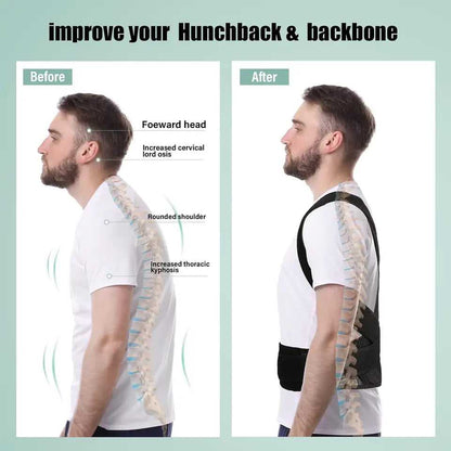 Instant Posture Corrector